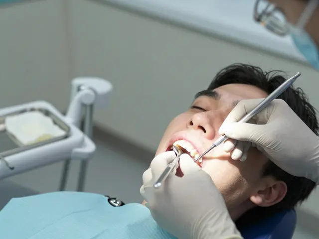 Jak se nasazuje můstek na zuby - krok za krokem a co je důležité vědět