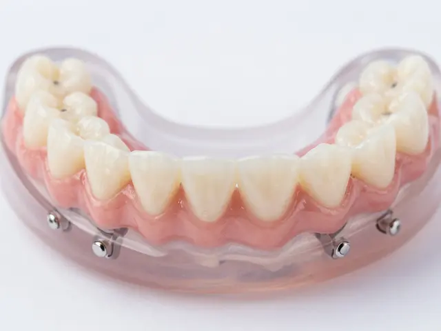 Nasazovací zuby: Jaké jsou trendy v roce 2025?