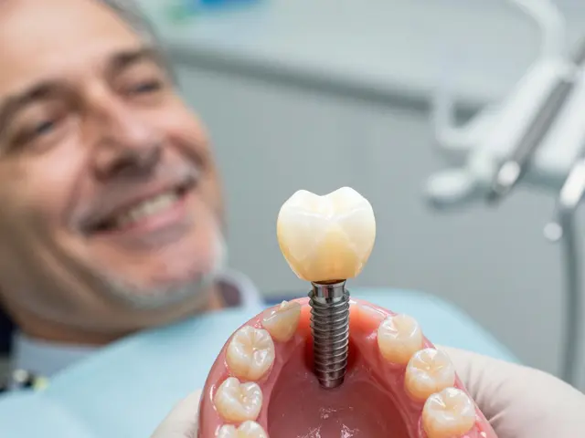 Jak často se mění implantáty? Vše, co potřebujete vědět o jejich životnosti