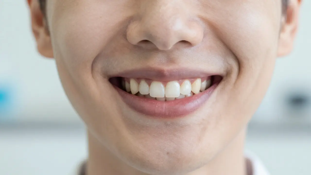 Jak se zbavit mezery mezi zuby? Přehled nejlepších estetických řešení