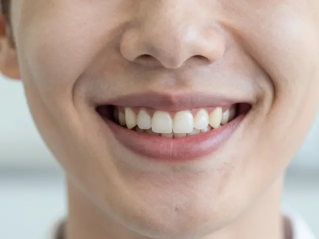 Jak se zbavit mezery mezi zuby? Přehled nejlepších estetických řešení