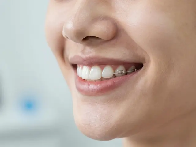 Kdy sundat retainer? Pravidla pro udržení rovných zubů