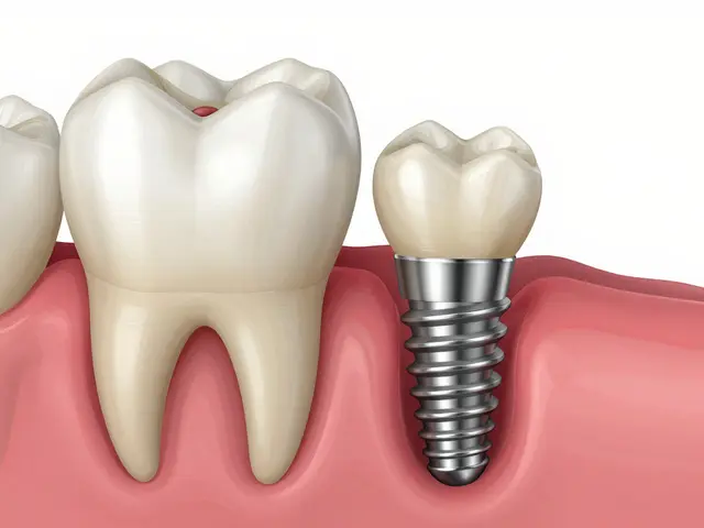 Zubní implantáty: Úplný průvodce údržbou a péčí pro dlouhou životnost