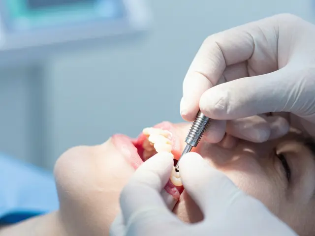 Zubní implantáty: Spolehlivé řešení ztráty zubů v roce 2026