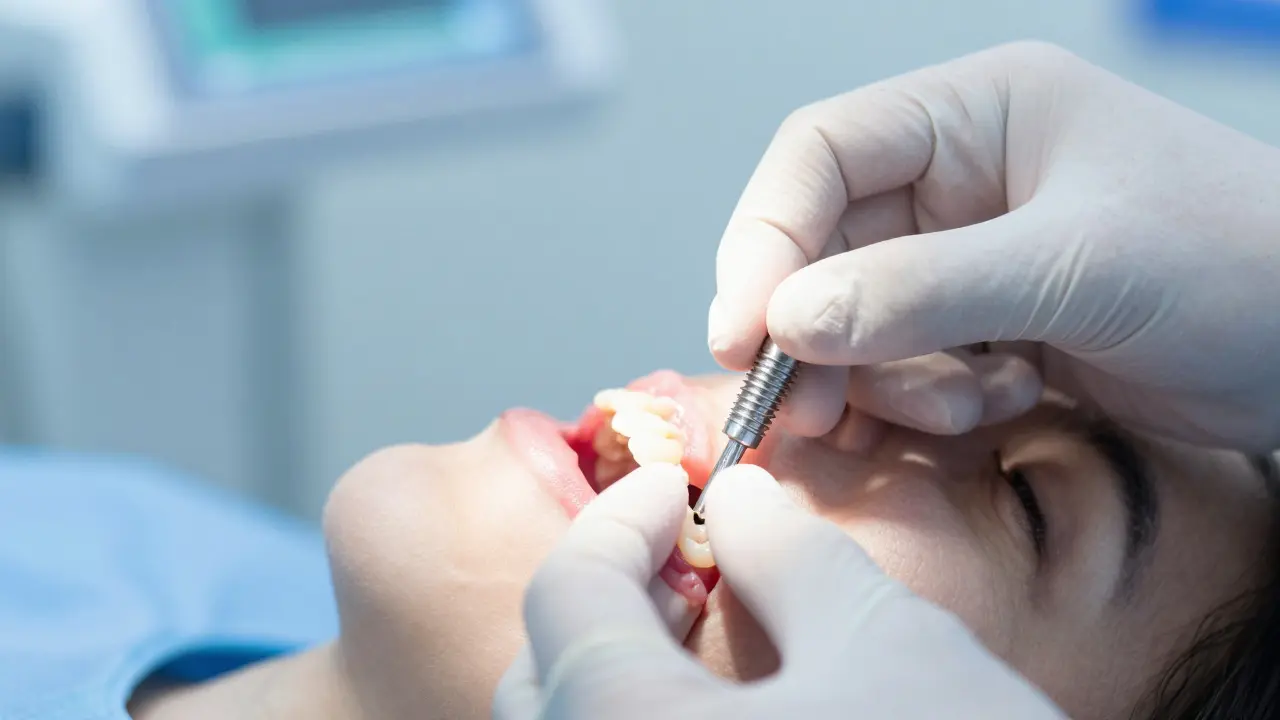 Zubní implantáty: Spolehlivé řešení ztráty zubů v roce 2026